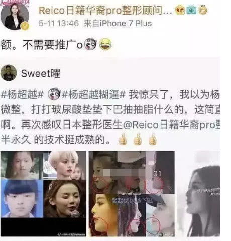  杨超越被曝整容和之前的照片一对比,哪里动过一目了然
