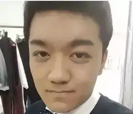  小雨整容式长大考上北影后颜值飙升,张一山都认不出了