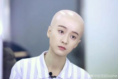  想问问张雪迎,有个醋精男朋友是什么样的体验