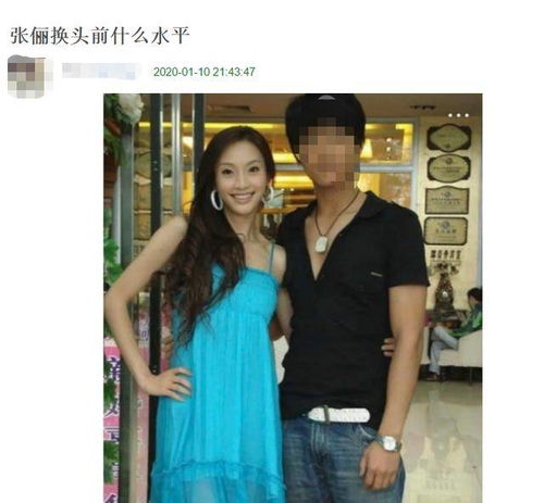  36岁张俪旧照被扒疑似整容,皮肤黝黑单眼皮,和现在判若两人