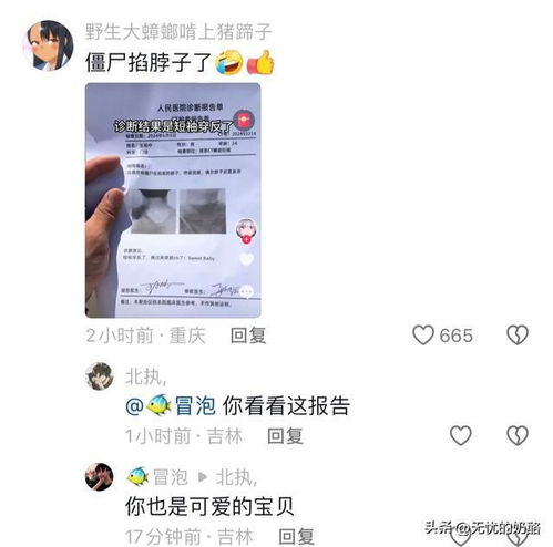  笑不活了,早上起来感觉呼吸困难,去医院检查结果短袖穿反了医生财神爷baby网易订阅