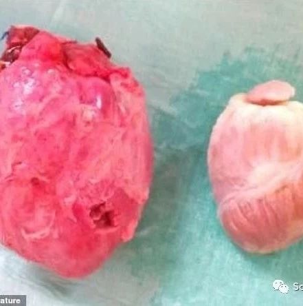  科学家将猪心脏移植狒狒体内距实现异种移植进一步