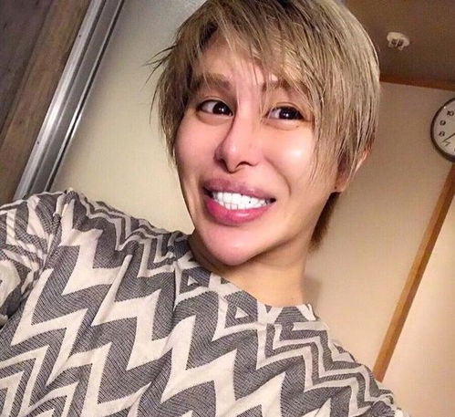  日本小伙因被欺负而整形,花费超过1亿日元,却没花自己一分钱
