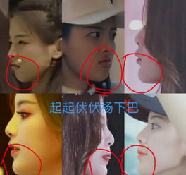  女大十八变还是整容了杨超越大量旧照曝光,整容医生也来凑热闹