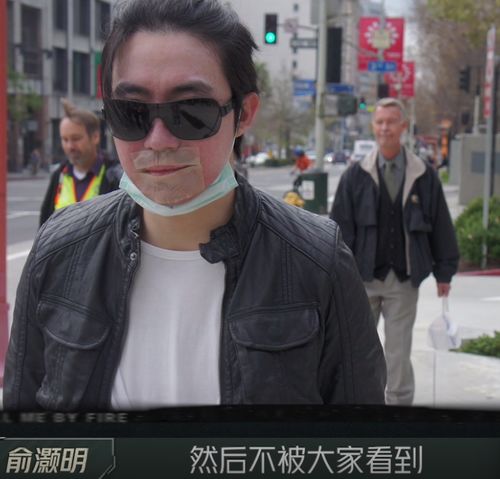  13年后,俞灏明晒烧伤照曾躲国外不见人,叹不留恋过去的高颜值