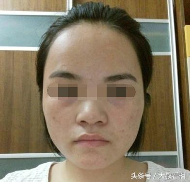  命苦女人的面相,此生注定难享夫运