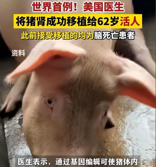  全球首例猪肾移植患者死亡,刚手术两个月,异种移植仍漫长