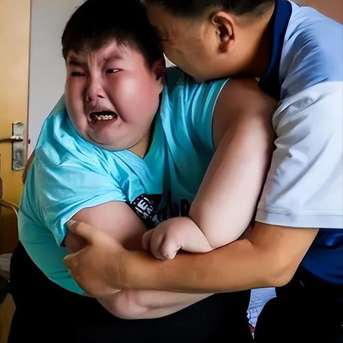  江西男孩患罕见病14岁重300斤,为活命切胃,临终痛哭我要减肥