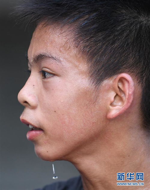  14岁独臂少年篮球追梦希望成为一名职业运动员